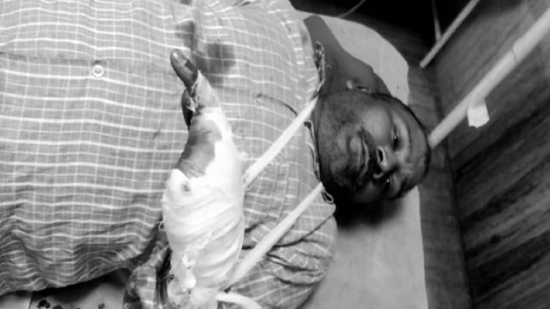 Punjab Shocker: Man's Fingers Chopped Off During Clash Between Two Groups in Gurdaspur, Second Incident in Less Than a Month