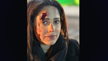 Akelli: Nushrratt Bharuccha Shares Her Wounded and Bruised Look From the Sets of Her Upcoming Thriller Film (View Pic)