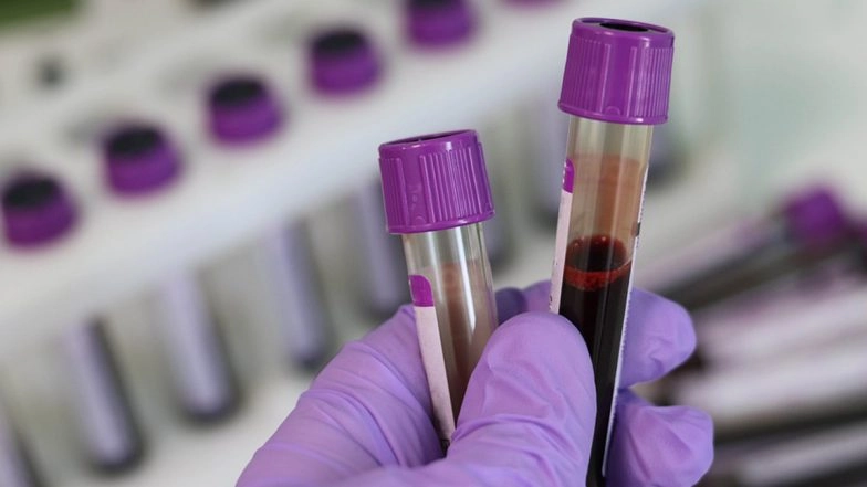 AI-Based Novel Cancer Testing: Indian Startup PredOmix Develops AI Based Blood Tests