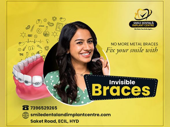 Business News | Smile Dental and Implant Centre Shared the Benefits of Invisible Braces over the Traditional Braces Treatment in a Recently Held Press Conference - Vimarsana News
