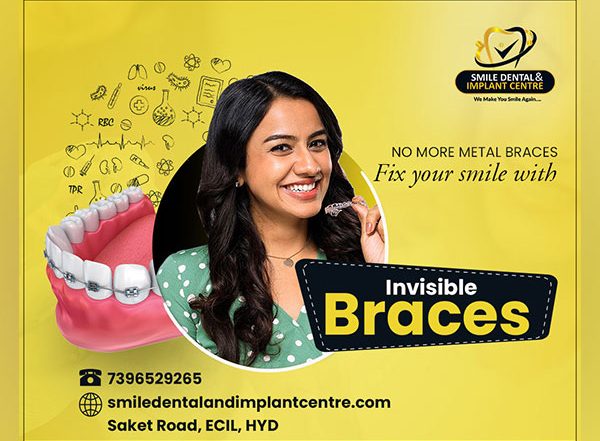 Business News | Smile Dental and Implant Centre Shared the Benefits of Invisible Braces over the Traditional Braces Treatment in a Recently Held Press Conference
