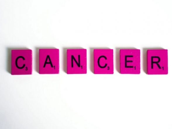 Science News | Researchers Discover How Cancer Evades Immune System Detection, Spreads - Vimarsana News