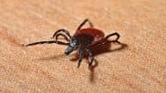 Powassan Virus Claims First Death in US This Year: What Is Powassan Virus Disease? From Symptoms to Transmission and Prevention, Know Everything About the Rare and Deadly Infection