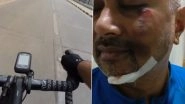 Mumbai Cyclist Meets With an Accident After His Tyre Gets Stuck in Gap of an Iron Grill Drain Laid on Road (Watch Video)