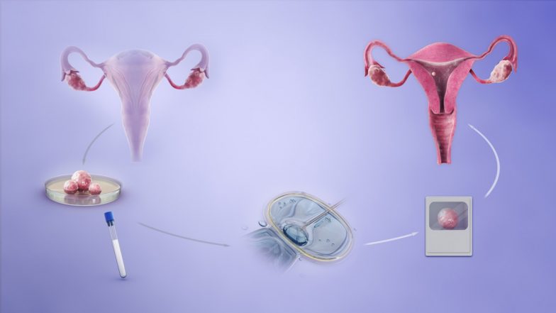 IVF Mix-Up in Delhi? Gurugram Couple Claims DNA Test Proved Twin Daughters Are Not Their Biological Children, Court Orders Probe