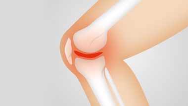 Common Blood Pressure Drugs Linked to Low Knee Replacement Risk, Reveals Study