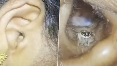 Spider in Ear! Terrifying Video Shows Baby Spider Crawling Out of Person's Ear