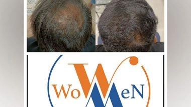 Business News | WowMen Clinic: 10+ Years & 4500+ Satisfied Clients, A Leader in Sustainable Cosmetic Treatments!