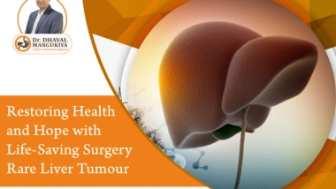 Business News | Dr Dhaval Mangukiya Performs Life-saving Surgery on Woman with Rare Liver Tumour, Restoring Health and Hope
