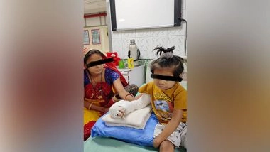 India News | Landmark Reconstructive Surgery: Toes of Foot Transplanted to Fingerless Hand at Delhi's Safdurjung Hospital