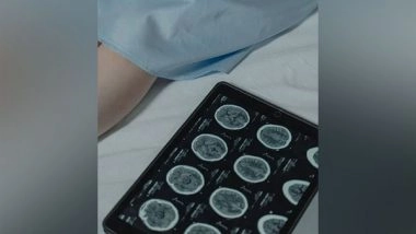 Science News | Monitoring Blood Vessel Changes Improves Detection of Brain Diseases: Study