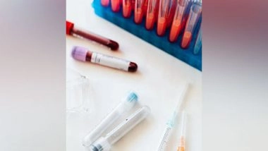 Health News | Study Discovers How New Blood Serum Test Detect Neurodegenerative Disorder