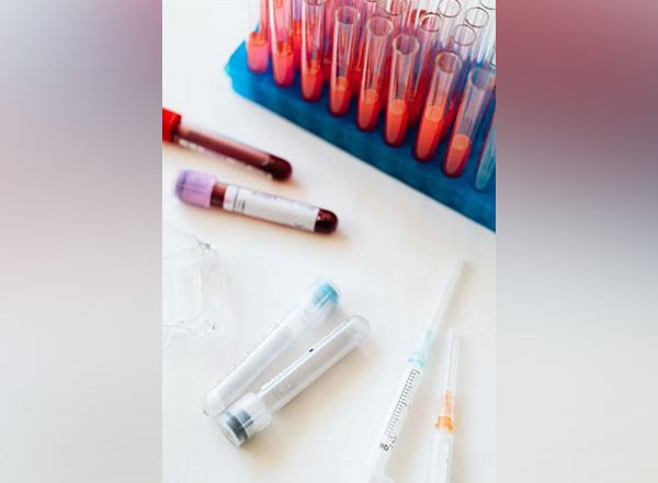 Health News | Study Discovers How New Blood Serum Test Detect Neurodegenerative Disorder