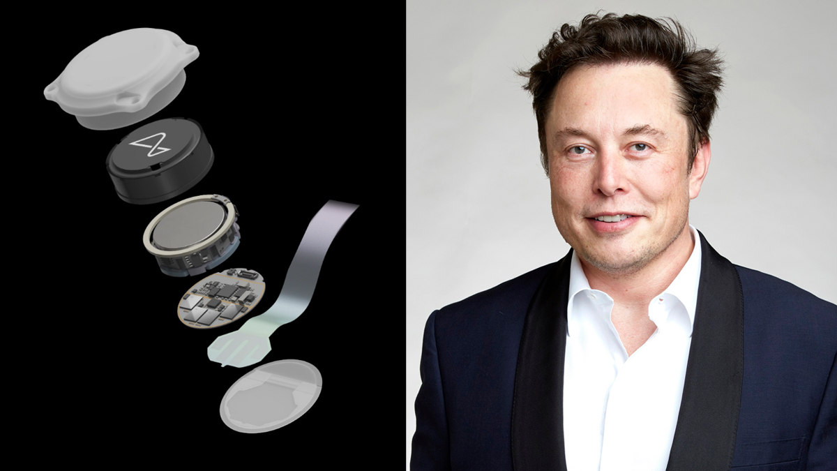 Technology News Elon Musk S Neuralink Brain Implant Gets Us Fda Approval For First Human