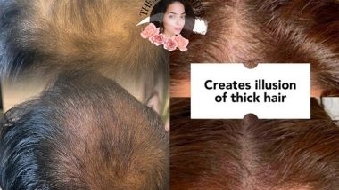 Business News | BrowMaster Now Offering Scalp Micro Pigmentation (SMP) Services in India