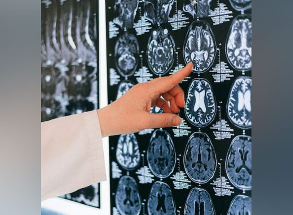 Science News | Researchers 'see' How the Brain Adapts to Different Situations Using Machine Learning