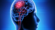 Health News | Study Finds How Brain Waves Can Predict Cognitive Impairment in Parkinson's Disease