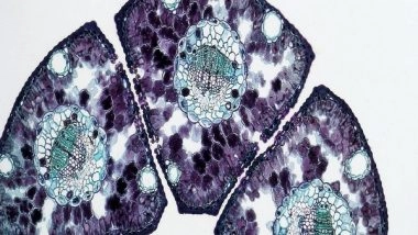 Health News | Study Finds Cancer Cells Can Adapt to Novel Drugs