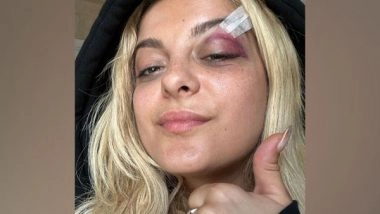 Entertainment News | Bebe Rexha Rushed off Stage After Being Hit in Head with Phone by Fan