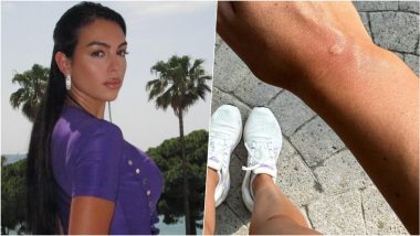 Bee Stings Cristiano Ronaldo's Girlfriend Georgina Rodriguez on Family's Day Out, View Photo From CR7 Jr's Pre-Birthday Celebrations on Instagram