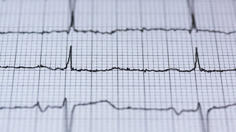 Portable Single Lead ECG Device Developed By AMU Student, Promises Accurate Records For Remote Cardiac Healthcare