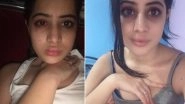 Uorfi Javed Shares Her Lip Filler Journey, Admits to Botched Surgeries (View Pics)
