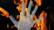 Rajasthan Shocker: Depressed Over Divorce After Love Marriage, Man Sets Himself on Fire in Jhunjhunu; Suicide Note Says &lsquo;No One Responsible For My Death&rsquo;