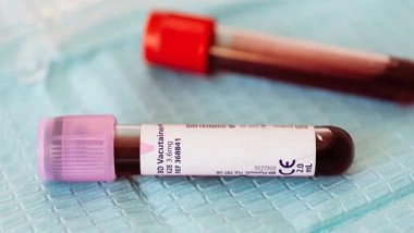 Health News | Lewy Body Disease Can Be Detected Before Symptoms Appear: Study