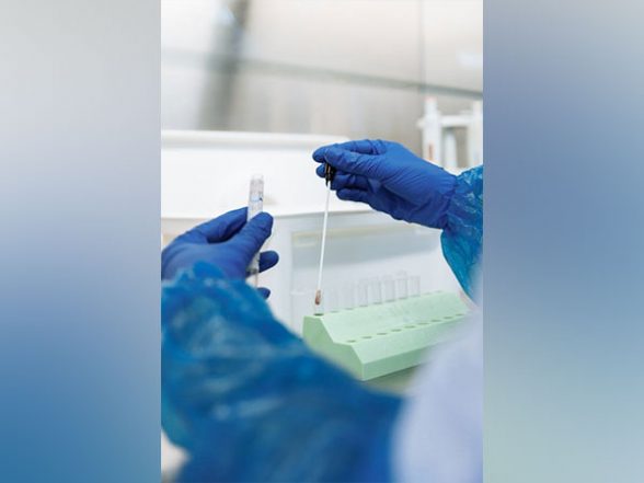 Health News | Scientific Breakthrough Uses MRNA Technology to Create a Highly Effective Malaria Vaccine - Vimarsana News