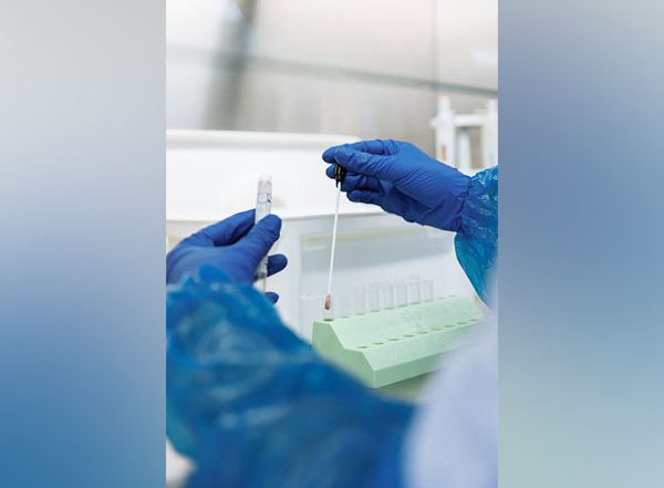 Health News | Scientific Breakthrough Uses MRNA Technology to Create a Highly Effective Malaria Vaccine