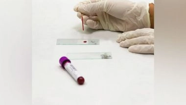 Health News | Digital Pathology Set to Be Game Changer in Medical Industry