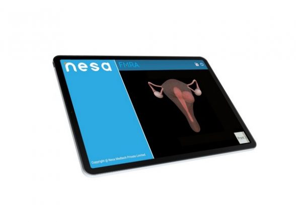 Business News | Nesa Medtech Receives US FDA Clearance for Technology in Women's Health - Vimarsana News