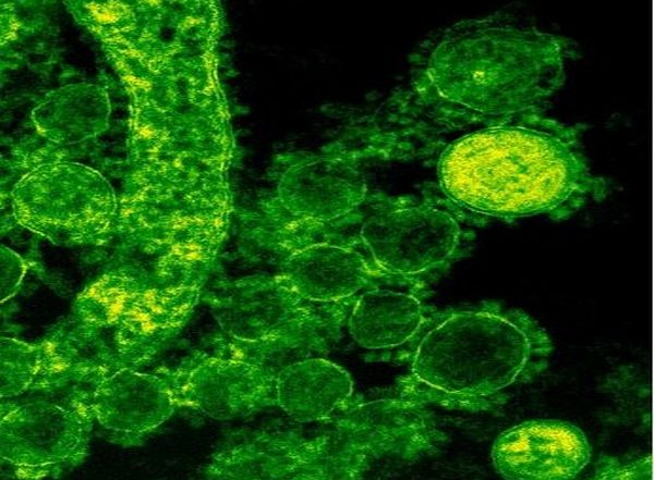 India News | Westernisation of Diets, Unhealthy Sedentary Lifestyle Cause of Fatty Liver: AIIMS Delhi