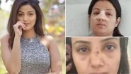 Kismat Ki Lakiro Se Fame Sumati Singh Opens Up About Her Nose Surgery After Devastating Incident (View Post)