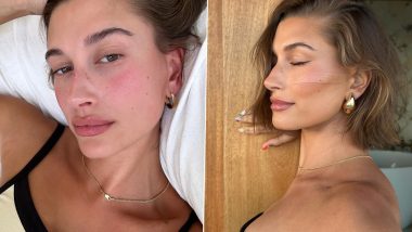 'Strawberry Girl Summer': Hailey Bieber Serves Major Skincare Goals, Shares Refreshing Pics On Insta