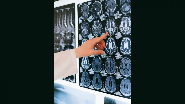 Living Alone Can Put People With Cognitive Decline at Risk, Reveals Research