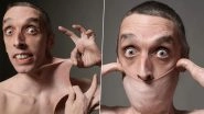 Gary Turner Can Stretch His Skin to a Length of 15.8 cm, Holds the Guinness World Record for Stretchiest Skin Since 1999 (See Pics)