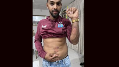 Nicholas Pooran Shares Picture of Bruises From Blows Sustained During IND vs WI 5th T20I 2023 (See Pics)