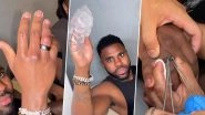 Jason Derulo Shares 'Embarrassing' Video From the Hospital Due to a Swollen Finger During Holiday in Turkey &ndash; Watch