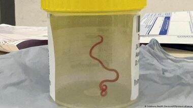 Live Parasitic Worm Plucked from Australian Woman's Brain