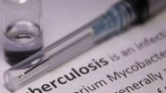 World News | Over 1000 People Infected with Tuberculosis in Afghanistan&rsquo;s Kandahar in Last Six Months