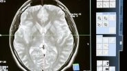 Science News | Study Establishes Direct Connection Between Brain Waves, Memory