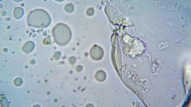 Health News | Study Finds AI System That Analyse Cells for Faster Diagnosis of Blood Diseases