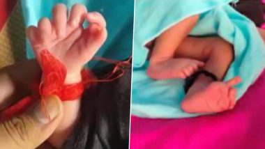 Rajasthan: Baby Born With 14 Fingers, 12 Toes in Deeg, Family Calls Her Incarnation of Goddess