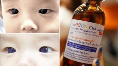 COVID-19 Treatment Effects: Infant’s Brown Eyes Turn Blue Overnight After Coronavirus Treatment in Thailand, Says Report