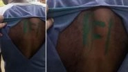 Kerala Shocker: Indian Army Jawan Allegedly Abducted, Attacked in Kollam, &lsquo;PFI&rsquo; Painted on His Back (Watch Video)