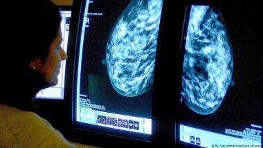 Cancer Cases in Under-50s Jump Drastically, Study Says