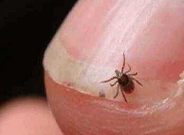 India News | Odisha Govt on Alert Mode After Scrub Typhus Kills 5 People