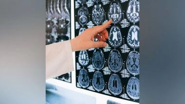 Health News | Here is How to Analyse Brain Signals to  Look into Brain Illness