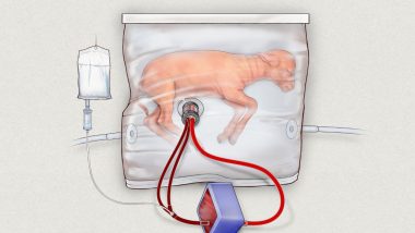 US Researchers Seek FDA Approval for 'Artificial Wombs' Human Trials: Report